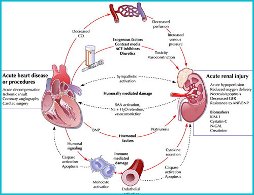 Examining the Key Symptoms and Causes of Kidney Failure - Medical ...