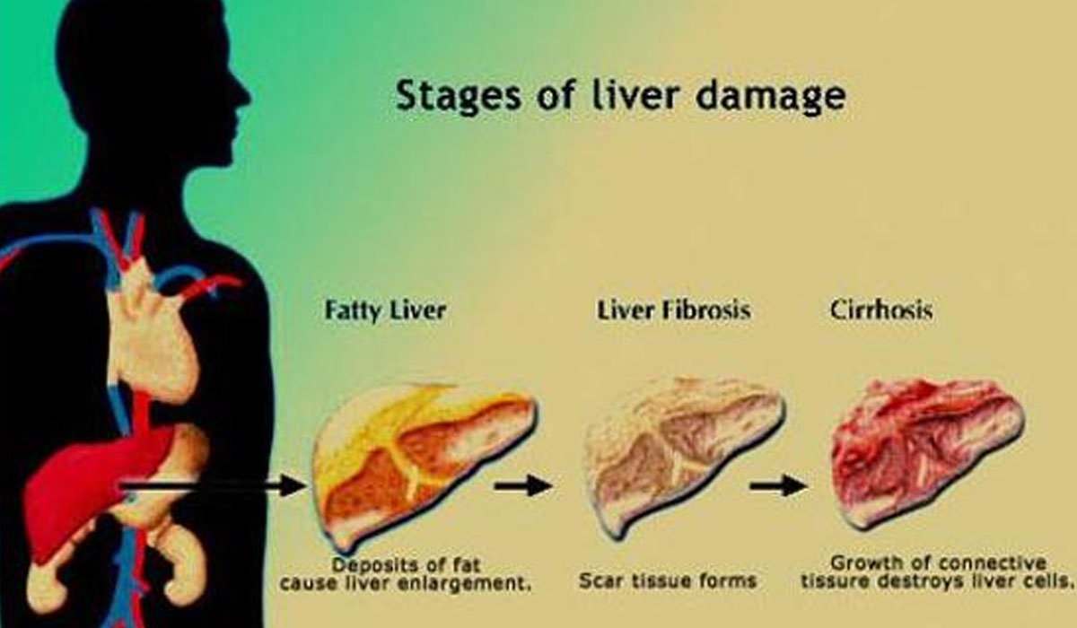 Mediconnect Awareness Mission - World Hepatitis Day on 28 July ...