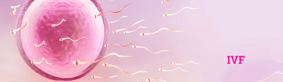 122_72 Infertility Treatment