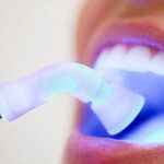 Laser Dental Treatments in India