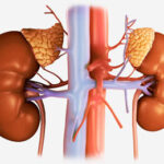 Kidney Disease (Renal failure) Treatment in India