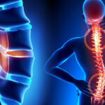 Neuro and Spine Surgery Cost in India