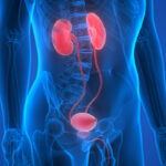Urology Treatment Cost in India